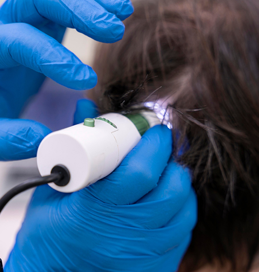 Low Level Laser Therapy Treatment for Hair Loss