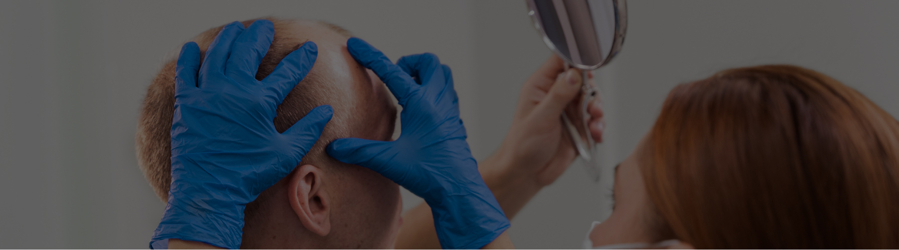 Choosing the Right Surgeon for Your Hair Transplant