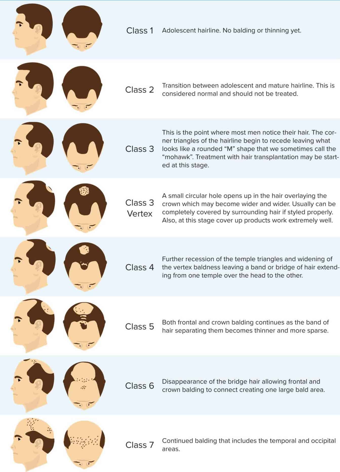 Hair Loss Type