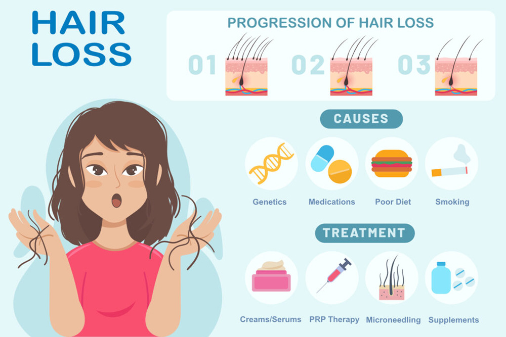 what causes hair loss in females, causes of hair thinning, female pattern hair loss