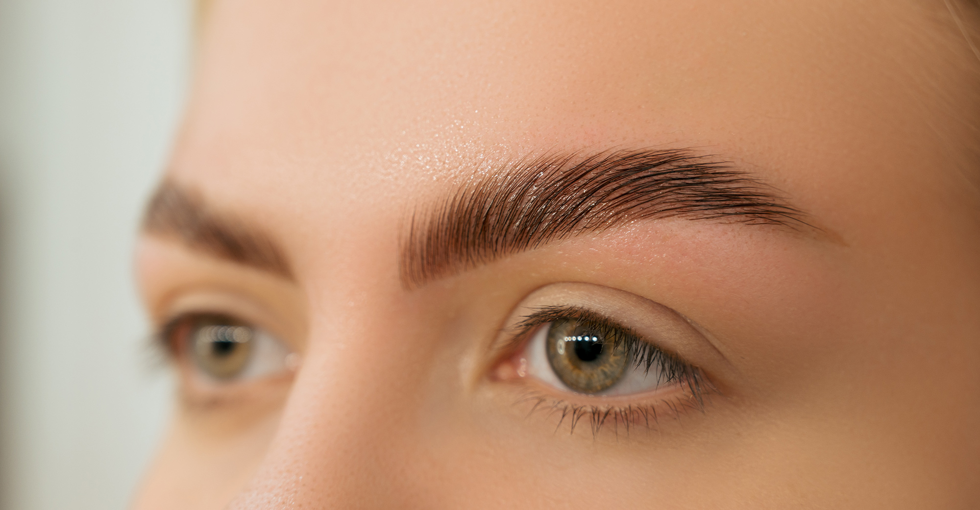 eyebrow hair transplant Melbourne eyebrow transplant Melbourne eyebrow restoration Melbourne eyebrow hair restoration eyebrow hair loss treatment