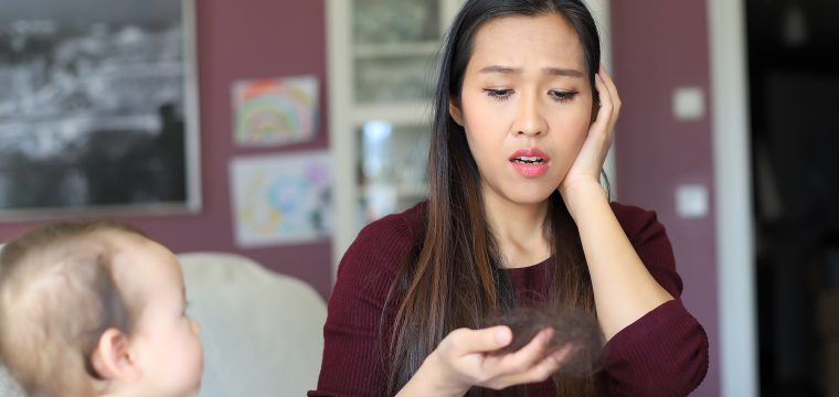 when does postpartum hair loss start postpartum hair loss postpartum hair loss Australia hair loss after pregnancy when does hair loss start after pregnancy