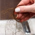 why is my hair falling out causes of hair loss reasons for hair falling out common hair loss causes