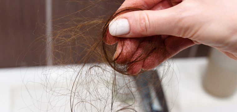 why is my hair falling out causes of hair loss reasons for hair falling out common hair loss causes