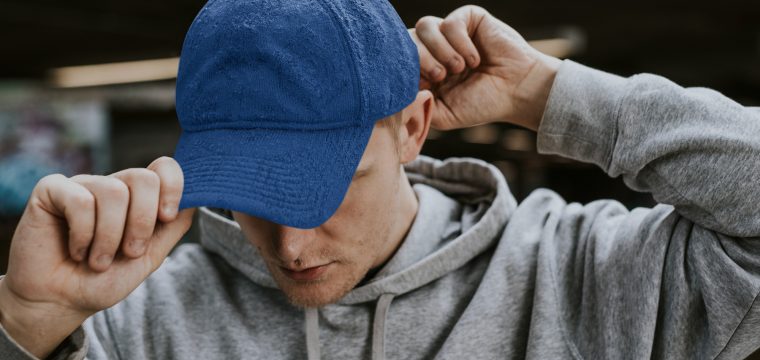 does wearing hats cause baldness does wearing hats cause hair loss do hats cause baldness can hats cause hair thinning