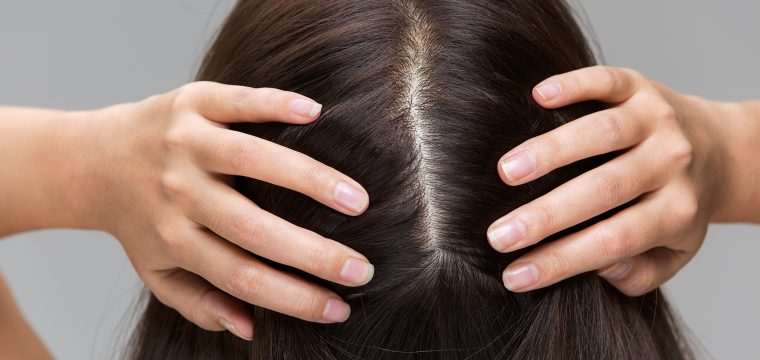 scalp care for hair growth healthy scalp scalp health how to improve scalp health