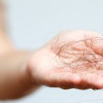 stages of hair loss hair loss stages early stage hair loss progressive hair loss