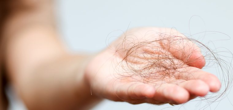 stages of hair loss hair loss stages early stage hair loss progressive hair loss