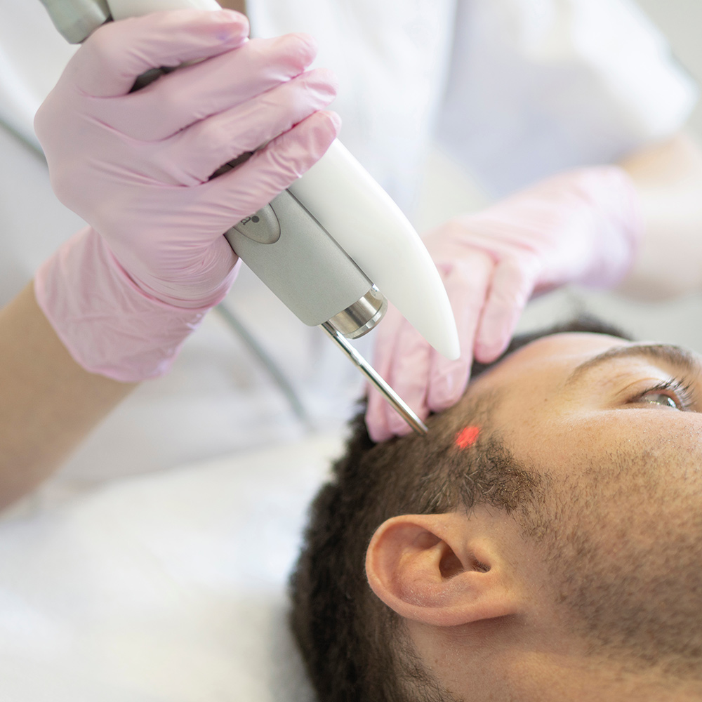 regrow hair without surgery, active hair follicles, non-surgical hair loss treatment
